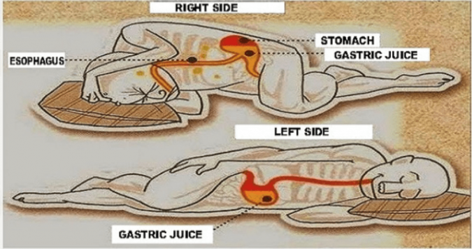 6 Simple Things You Can Do To Alleviate Stomach Problems Effectively